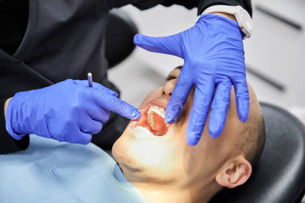 Best Chipped Tooth Repair Near Me  in Dunlap, IN