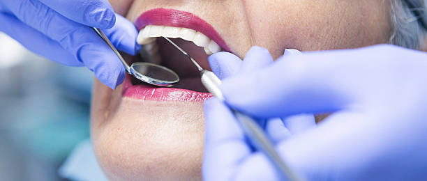 Best Chipped Tooth Repair Near Me  in Dunlap, IN